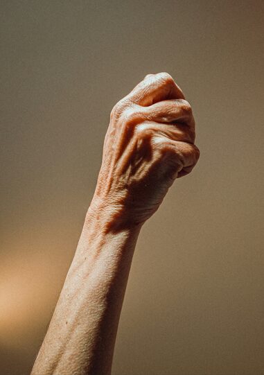 脳卒中後の痙縮パターン解説②｜上肢 (腕・手指) にみられる典型的な屈曲パターンとは？