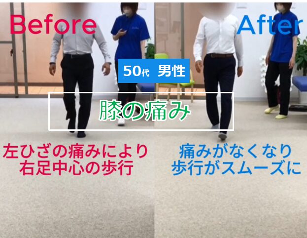 【改善事例】痛みなく走れるようになりました (S様・50代)